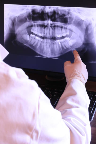 Best Emergency Root Canal Treatment in Manchester, VA
